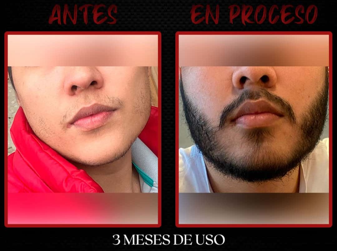 Aceite para Barba | Cuidado y Estilo para una Barba Saludable