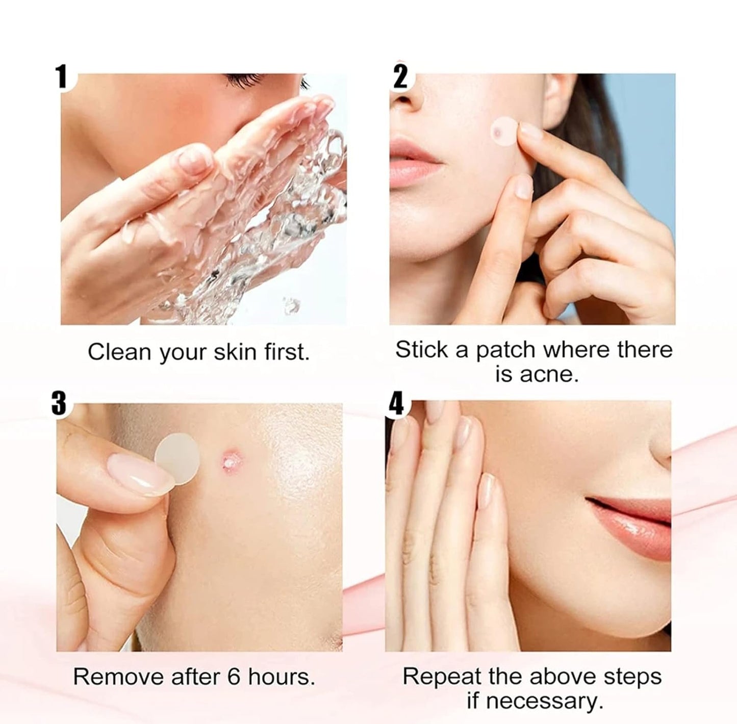Parches Hidrocoloides Para Acné 120 pcs – Cura Rápida y Efectiva para Espinillas