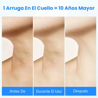 Equipo Rejuvenecedor Facial y de Cuello