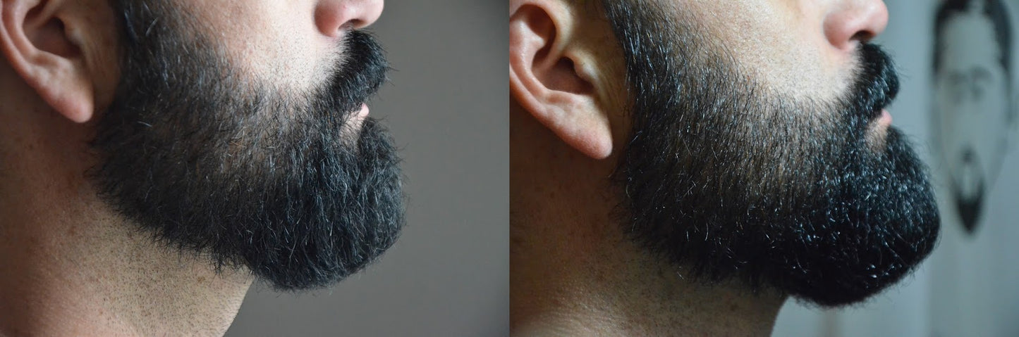 Aceite para Barba | Cuidado y Estilo para una Barba Saludable