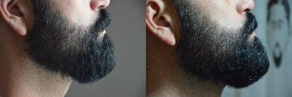 Aceite para Barba | Cuidado y Estilo para una Barba Saludable