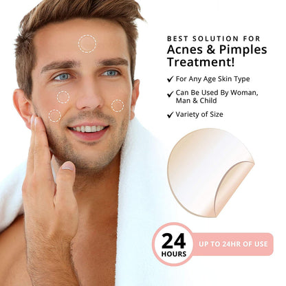 Parches Hidrocoloides Para Acné 120 pcs – Cura Rápida y Efectiva para Espinillas
